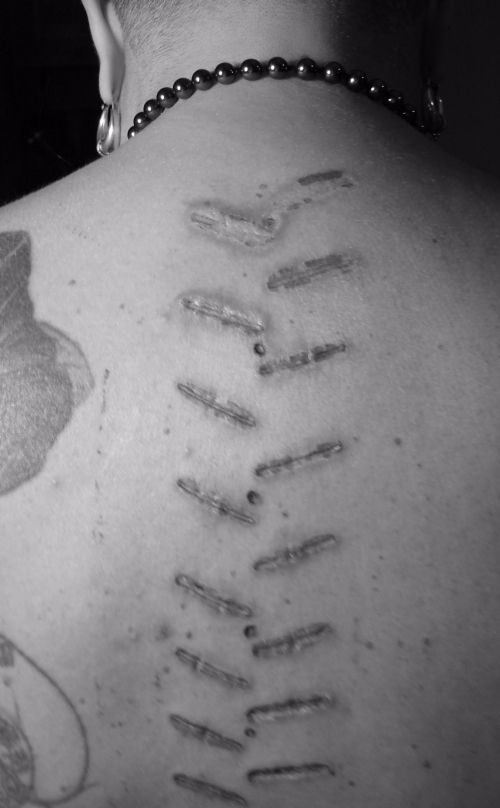 retour de skinbranding