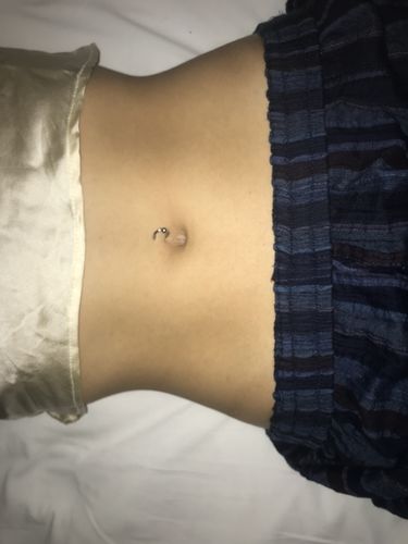 Rutulinis žiedas (BCR)