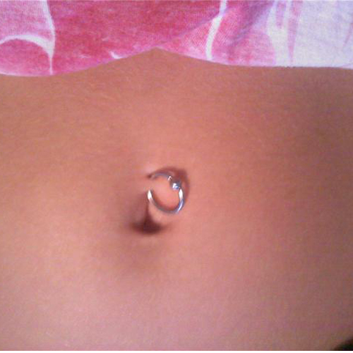 Rutulinis žiedas (BCR)