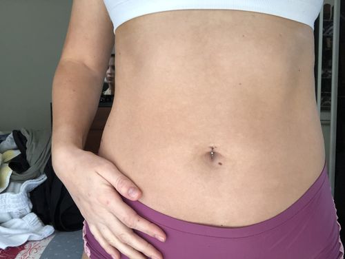 Rutulinis žiedas (BCR)