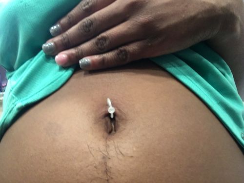 Rutulinis žiedas (BCR)