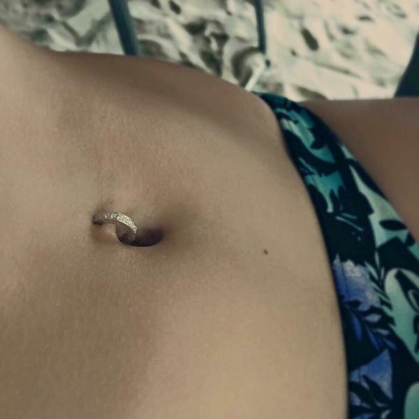 Rutulinis žiedas (BCR)