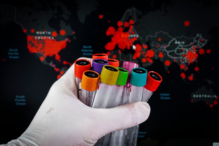 Ținând probe de sânge în mână răspândind covid-19 în întreaga lume