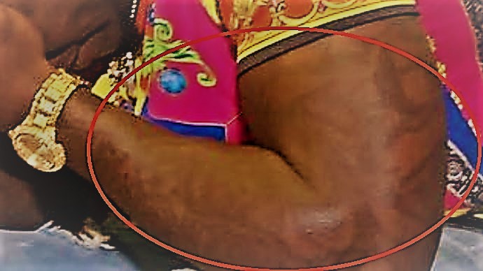 Encre de bras gauche Deebo