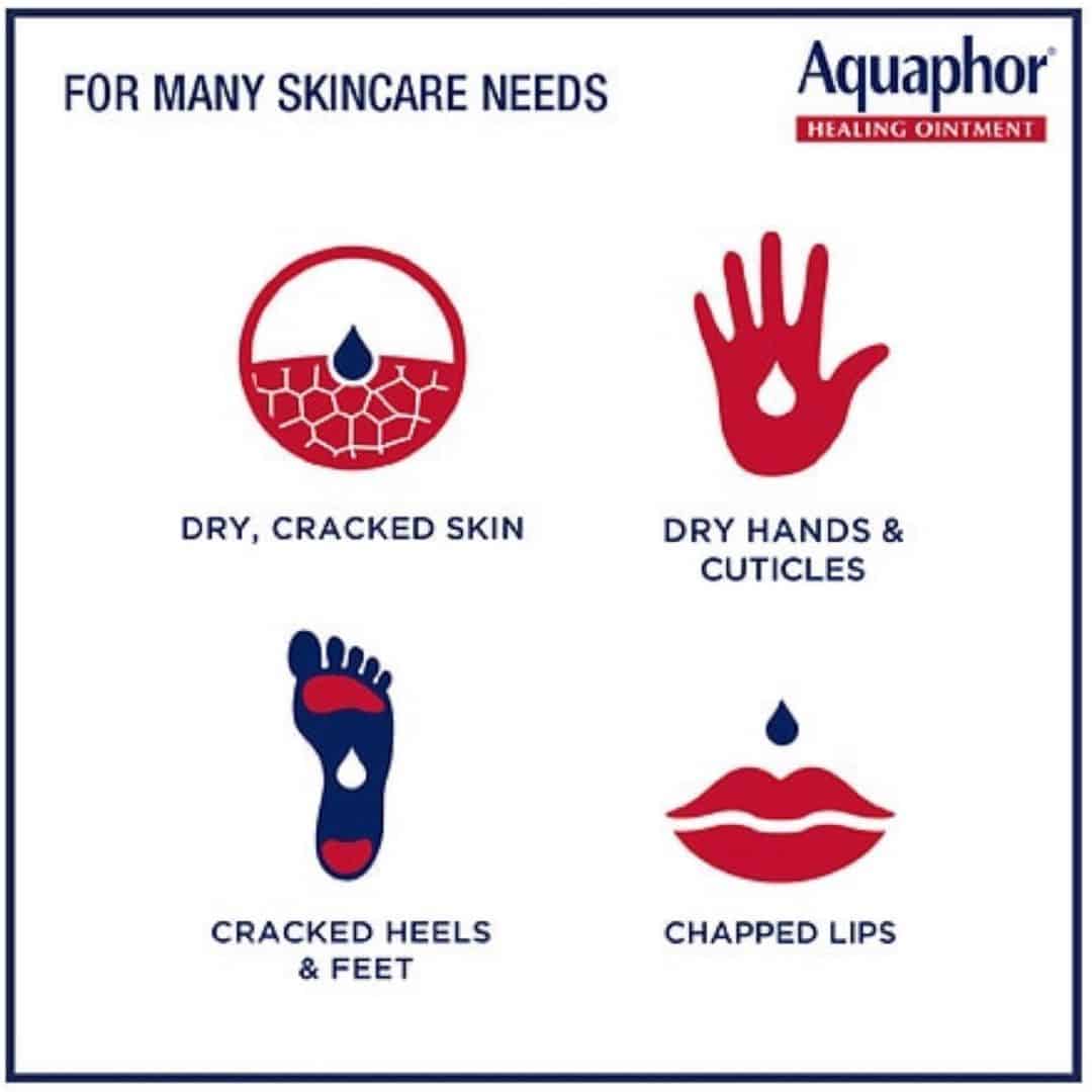 kje uporabiti Aquaphor