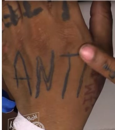 Succo WRLD ANTI Tattoo