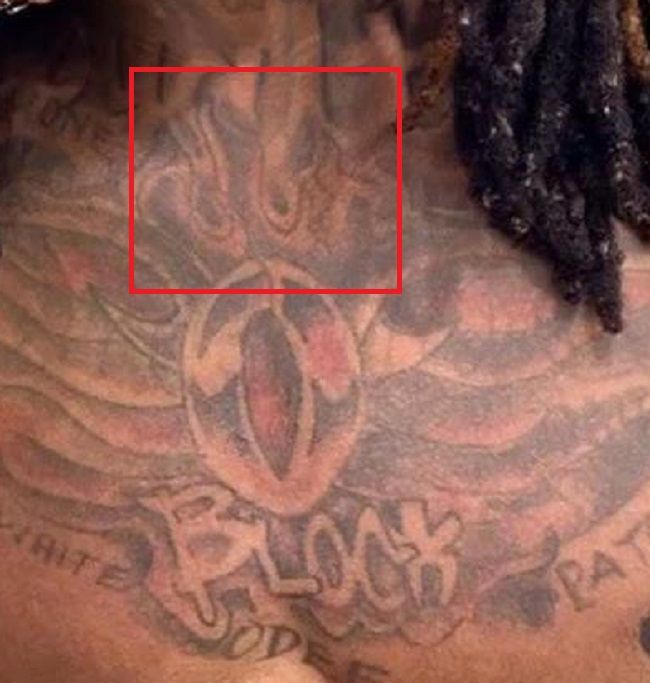 Kralj von prsni koš