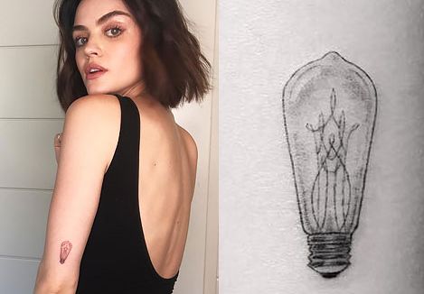 ルーシーヘイル左肘