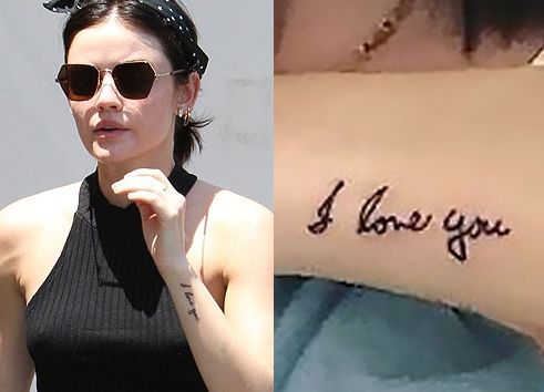 ルーシーヘイル左前腕