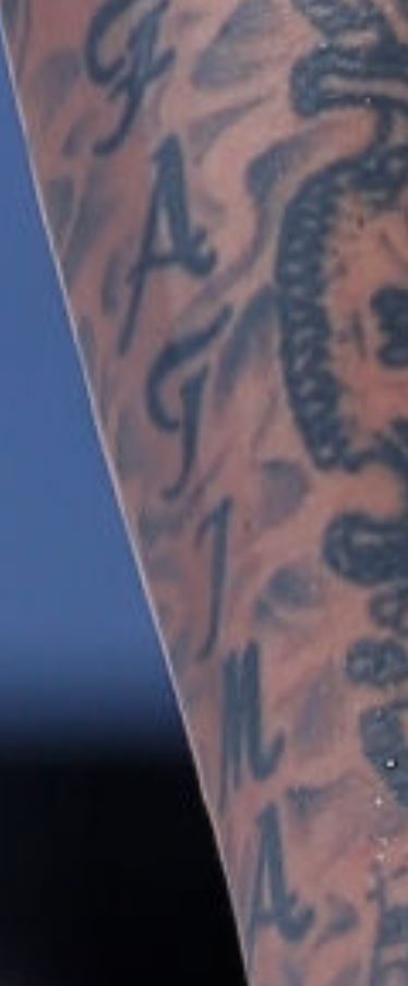 Michael torcendo no braço esquerdo