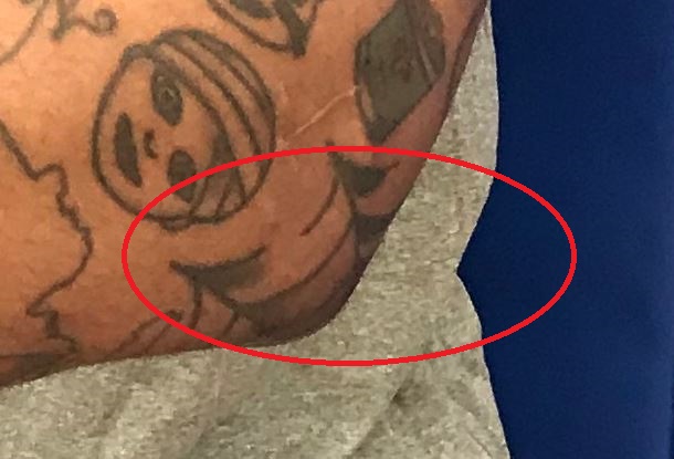 Mike Scott Spiderweb na levem komolcu