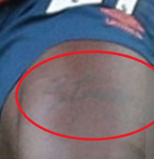 Moise太もものタトゥー