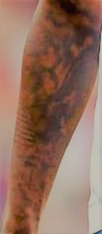 Moise前腕タトゥー