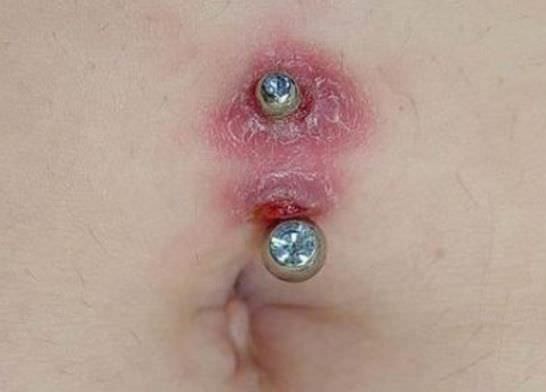 Piercing za popek