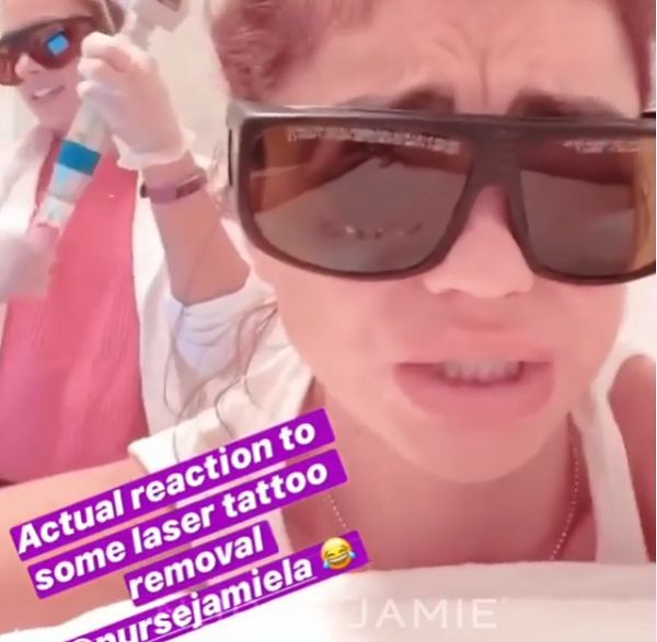 Sarah Hyland-foto rimozione del tatuaggio laser