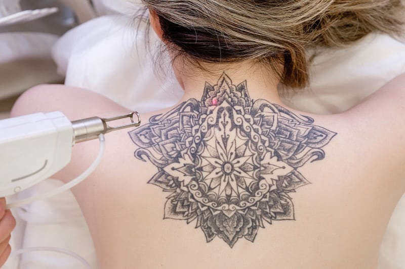 O que acontece se um tatuador errar, tatuagem salva, remoção